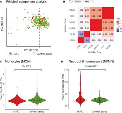 Central Multifocal Choroiditis: Platelet Granularity as a Potential Marker for Treatment With Steroid-Sparing Immunomodulatory Therapy